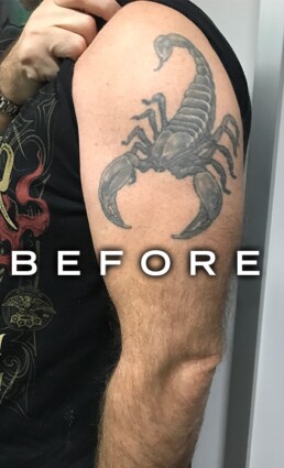 Tatuaggio da coprire